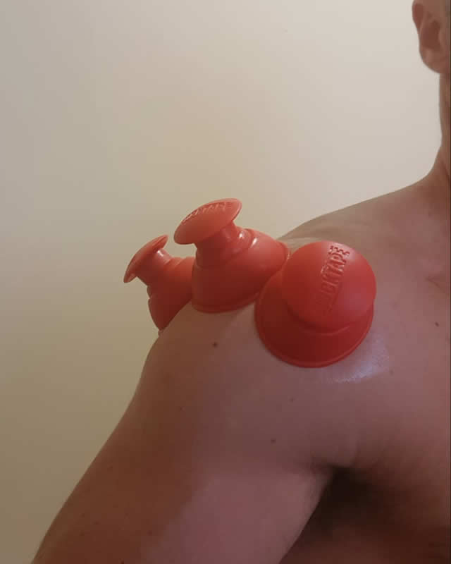 Cupping Therapy with Oliver Ody - Personal Trainer
