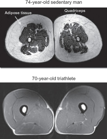 Sedentary vs Triathlete