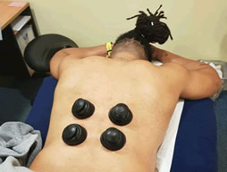 Cupping Therapy